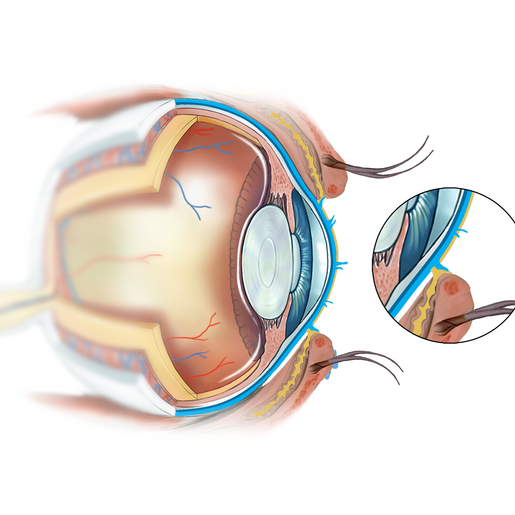 Blephagel utilisation : Guide pratique pour un soin optimal des yeux