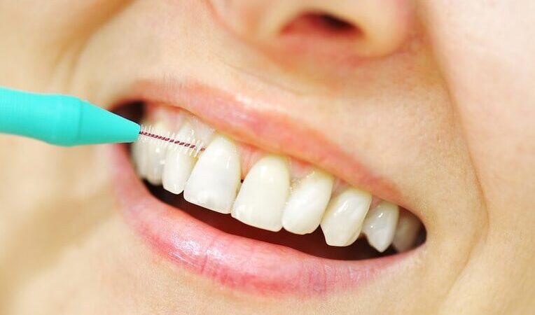 Comment utiliser brossette interdentaire pour une hygiène parfaite ?