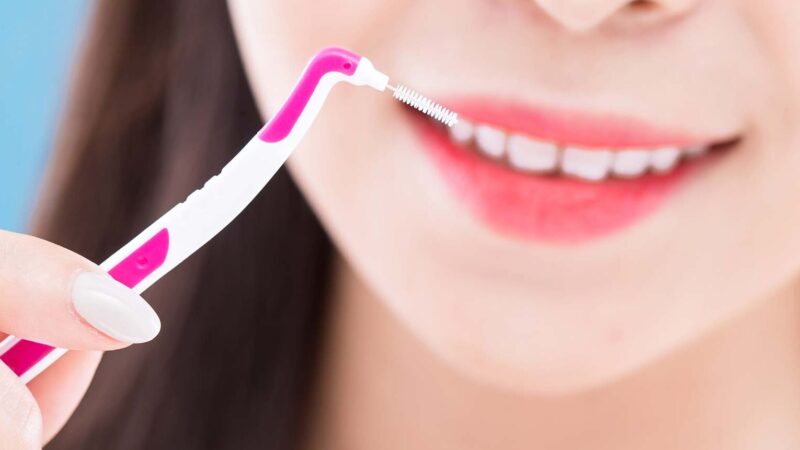 Comment utiliser les brossettes interdentaires pour un sourire éclatant !