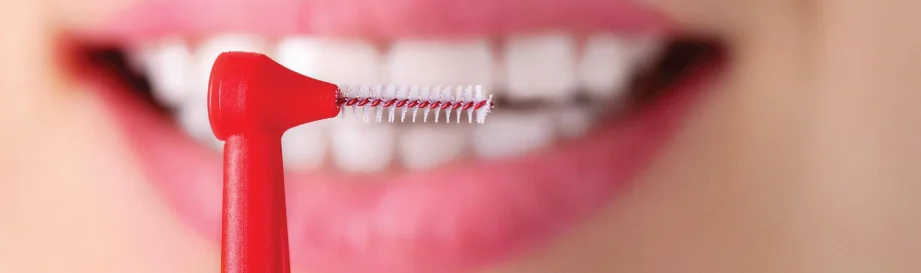 Utilisation brossette dentaire : Guide Pratique pour un Sourire Éclatant