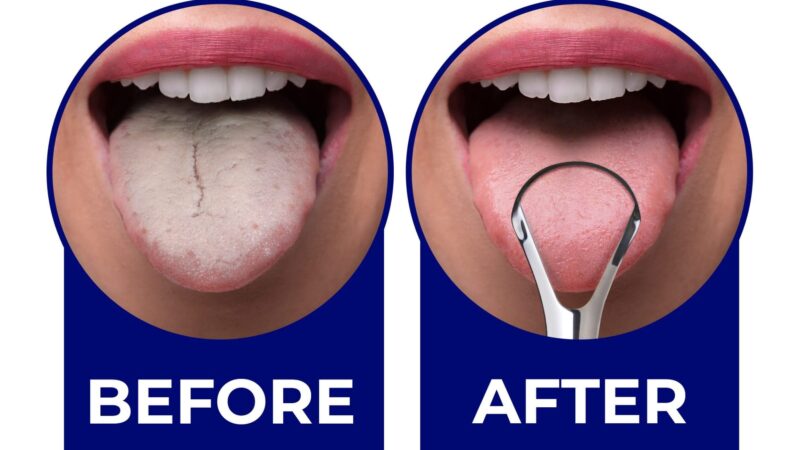 Utilisation gratte langue : Améliorez votre hygiène buccale !