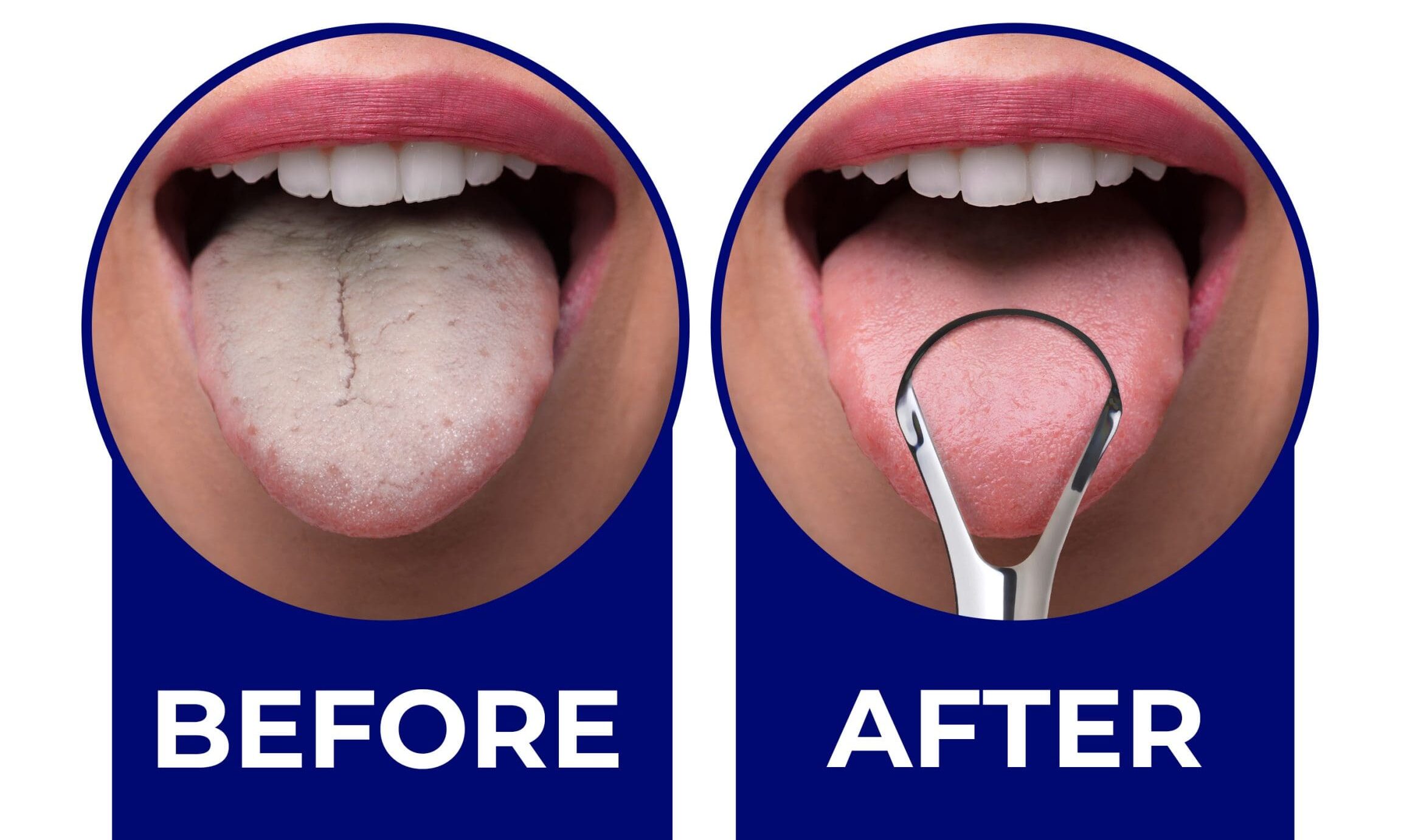 Utilisation gratte langue : Améliorez votre hygiène buccale !
